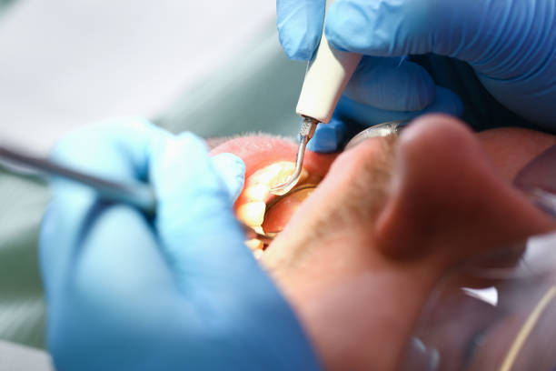 Best Broken or Cracked Tooth Emergency Dentist in Kernersville, NC